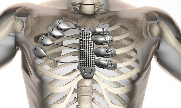 The Medical Revolution Fueled by Commercially Pure Titanium