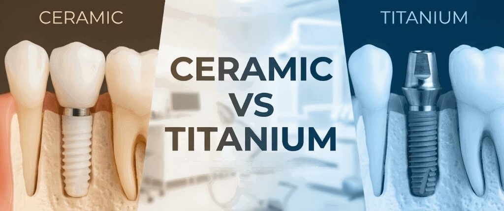 Is Titanium Better Than Ceramic?